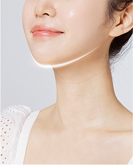 double chin lift korea - Double Chin Lift